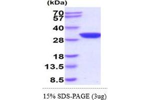 Adenylate Kinase 2 Protein (AK2) (AA 1-239) (His tag)