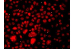Immunofluorescence analysis of A549 cells using RELA antibody. (NF-kB p65 Antikörper)