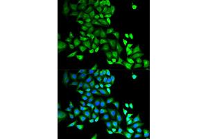 Immunofluorescence (IF) image for anti-GDP Dissociation Inhibitor 1 (GDI1) antibody (ABIN1876650)