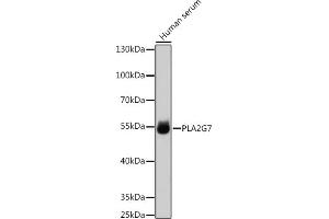 Western blot analysis of extracts of Human serum, using PLG7 antibody (ABIN6131873, ABIN6145734, ABIN6145736 and ABIN6218012) at 1:1000 dilution. (PLA2G7 Antikörper  (AA 51-240))