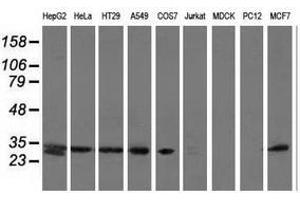 Image no. 2 for anti-Sepiapterin Reductase (SPR) antibody (ABIN1501114) (SPR Antikörper)