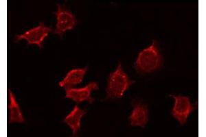 ABIN6272358 staining MCF7 by IF/ICC. (NEURL Antikörper  (Internal Region))