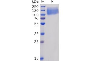 Human CEA Protein, His Tag on SDS-PAGE under reducing condition.