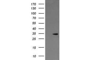 Image no. 2 for anti-Leucine-Rich Repeat-Containing G Protein-Coupled Receptor 6 (LGR6) (AA 25-250) antibody (ABIN1491277) (LGR6 Antikörper  (AA 25-250))