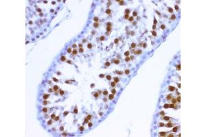 IHC-P: MCAK antibody testing of rat testis tissue (KIF2C Antikörper  (AA 531-725))