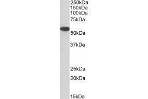 Biotinylated ABIN5539475 (1µg/ml) staining of Jurkat lysate (35µg protein in RIPA buffer), exactly mirroring its parental non-biotinylated product. (Annexin A11 Antikörper  (N-Term) (Biotin))