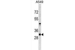 Western Blotting (WB) image for anti-Ras Association (RalGDS/AF-6) Domain Family Member 3 (RASSF3) antibody (ABIN2999748) (RASSF3 Antikörper)