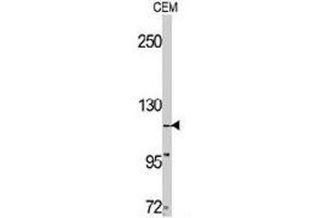 Western blot analysis of TNK2 polyclonal antibody  in CEM cell line lysates (35 ug/lane). (TNK2 Antikörper  (C-Term))
