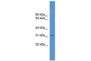 WB Suggested Anti-HAVCR2 Antibody Titration: 0.