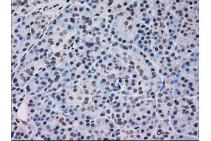 Immunohistochemical staining of paraffin-embedded pancreas tissue using anti-MAPK12mouse monoclonal antibody. (MAPK12 Antikörper)