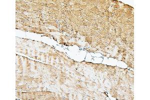 IHC analysis of Cofilin-2 using anti-Cofilin-2 antibody (ABIN7602747).