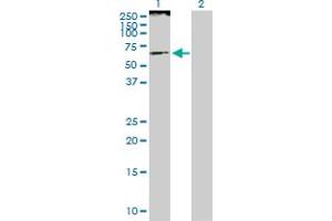 Western Blot analysis of SMARCE1 expression in transfected 293T cell line by SMARCE1 MaxPab polyclonal antibody. (SMARCE1 Antikörper  (AA 1-411))
