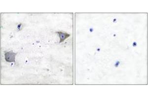 Immunohistochemistry (IHC) image for anti-Platelet Derived Growth Factor Receptor alpha (PDGFRA) (AA 1031-1080) antibody (ABIN2889249) (PDGFRA Antikörper  (AA 1031-1080))