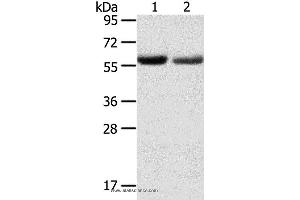 Western blot analysis of Human normal stomach and stomach cancer tissue, using SLC16A9 Polyclonal Antibody at dilution of 1:200