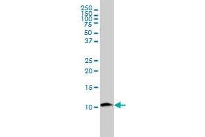 Western Blotting (WB) image for anti-beta-2-Microglobulin (B2M) (AA 1-119) antibody (ABIN560019)