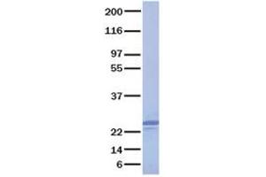Validation with Western Blot (FGF19 Protein)