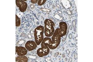 Immunohistochemical staining (Formalin-fixed paraffin-embedded sections) of human kidney with IL17RB polyclonal antibody  shows strong cytoplasmic positivity in tubular cells. (IL17 Receptor B Antikörper)