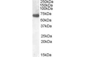 Image no. 1 for anti-Glucokinase (Hexokinase 4) Regulator (GCKR) (N-Term) antibody (ABIN375154) (GCKR Antikörper  (N-Term))