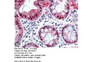 Immunohistochemistry with Human Colon lysate tissue at an antibody concentration of 5. (SCML1 Antikörper  (Middle Region))
