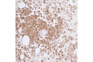 Immunohistochemistry (IHC) image for anti-CD33 (CD33) (AA 314-364) antibody (ABIN7453876)