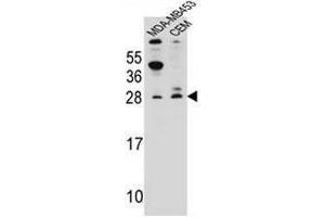 IFI6 Antibody (N-term) western blot analysis in MDA-MB453,CEM cell line lysates (35µg/lane).