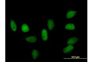 Immunofluorescence of purified MaxPab rabbit antibody to CBX5 on HeLa cell. (CBX5 Antikörper  (AA 1-191))