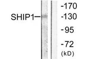 Western blot analysis of extracts from mouse brain cells, using SHIP1 (Ab-1020) Antibody. (INPP5D Antikörper  (AA 987-1036))