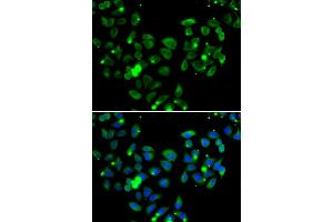 Immunofluorescence analysis of A549 cells using CARD11 antibody (ABIN5974295). (CARD11 Antikörper)