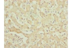 Immunohistochemistry of paraffin-embedded human liver tissue using ABIN7174957 at dilution of 1:100 (MYO5B Antikörper  (AA 1440-1690))