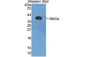 Western blot analysis of the recombinant protein. (HSF4 Antikörper  (AA 91-407))