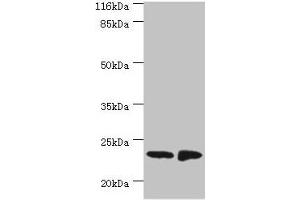 Western blot All lanes: C7orf50 antibody at 2 μg/mL Lane 1: A549 whole cell lysate Lane 2: MCF-7 whole cell lysate Secondary Goat polyclonal to rabbit IgG at 1/10000 dilution Predicted band size: 23 kDa Observed band size: 23 kDa (SAMD9 Antikörper  (AA 1-194))