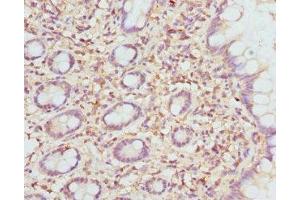 Immunohistochemistry of paraffin-embedded human small intestine tissue using ABIN7151501 at dilution of 1:100 (ETFDH Antikörper  (AA 318-617))