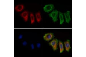 ABIN7094741 and ABIN7098792 staining Hela cells by IF/ICC.