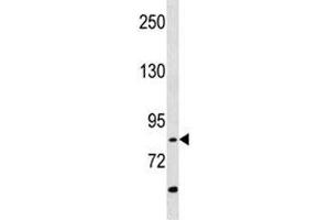 RIPK4 antibody western blot analysis in A549 lysate (RIPK4 Antikörper  (AA 802-832))