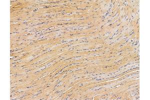 ABIN6264298 and ABIN6279665 at 1/100 staining rat muscle tissue by IHC-P.