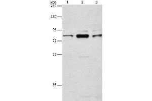Western Blot analysis of Human brain malignant glioma tissue, A172 and 293T cell using ARHGEF7 Polyclonal Antibody at dilution of 1:800 (ARHGEF7 Antikörper)