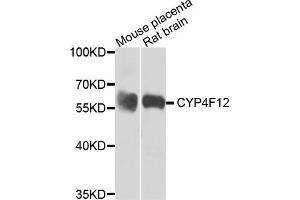 Western blot analysis of extracts of various cell lines, using CYP4F12 antibody (ABIN5974476) at 1/1000 dilution. (CYP4F12 Antikörper)
