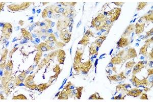 Immunohistochemistry of paraffin-embedded Human stomach using HYAL1 Polyclonal Antibody at dilution of 1:100 (40x lens). (HYAL1 Antikörper)