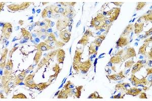 Immunohistochemistry of paraffin-embedded Human stomach using HYAL1 Polyclonal Antibody at dilution of 1:100 (40x lens). (HYAL1 Antikörper)