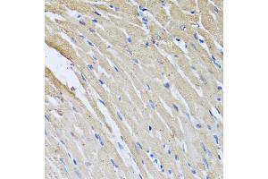 Immunohistochemistry of paraffin-embedded rat heart using CRHBP antibody (ABIN5973945) at dilution of 1/100 (40x lens). (CRHBP Antikörper)