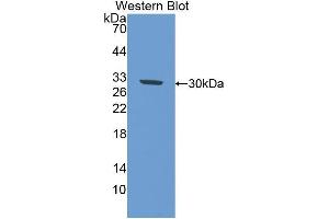 Western Blotting (WB) image for anti-Interleukin 17 Receptor D (IL17RD) (AA 356-603) antibody (ABIN1859364) (IL17RD Antikörper  (AA 356-603))