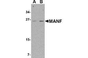Western Blotting (WB) image for anti-Mesencephalic Astrocyte-Derived Neurotrophic Factor (MANF) (C-Term) antibody (ABIN1030505) (MANF Antikörper  (C-Term))