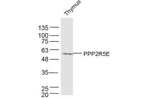 Image no. 1 for anti-Protein Phosphatase 2, Regulatory Subunit B', epsilon Isoform (PPP2R5E) (AA 121-220) antibody (ABIN5675603)