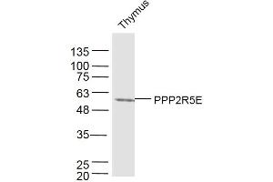 Mouse thymus lysates probed with PPP2R5E Polyclonal Antibody, Unconjugated  at 1:300 dilution and 4˚C overnight incubation. (PPP2R5E Antikörper  (AA 121-220))