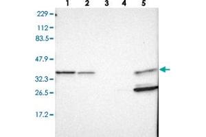 Western blot analysis of Lane 1: RT-4, Lane 2: U-251 MG, Lane 3: Human Plasma, Lane 4: Liver, Lane 5: Tonsil with ARPC1B polyclonal antibody .