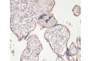 Immunohistochemistry of paraffin-embedded Human placenta using ASC / TMS1 Polyclonal Antibody at dilution of 1:100 (40x lens). (PYCARD Antikörper)