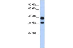 Western Blotting (WB) image for anti-Chitinase, Acidic (CHIA) antibody (ABIN2463911)