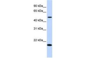 Image no. 1 for anti-Zinc Finger Protein 493 (ZNF493) (N-Term) antibody (ABIN6741148) (ZNF493 Antikörper  (N-Term))