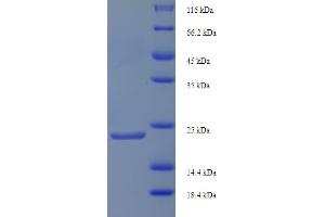 SDS-PAGE (SDS) image for N-Acylsphingosine Amidohydrolase (Non-Lysosomal Ceramidase) 2B (ASAH2B) (AA 1-165), (full length) protein (His tag) (ABIN5709087) (ASA2B Protein (AA 1-165, full length) (His tag))