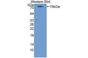 Western blot analysis of recombinant Human ATP2A2. (ATP2A2 Antikörper  (AA 315-756))